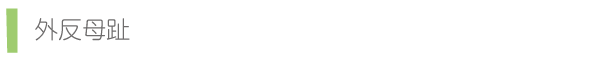 外反母趾