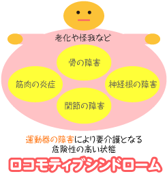 ロコモティブシンドローム